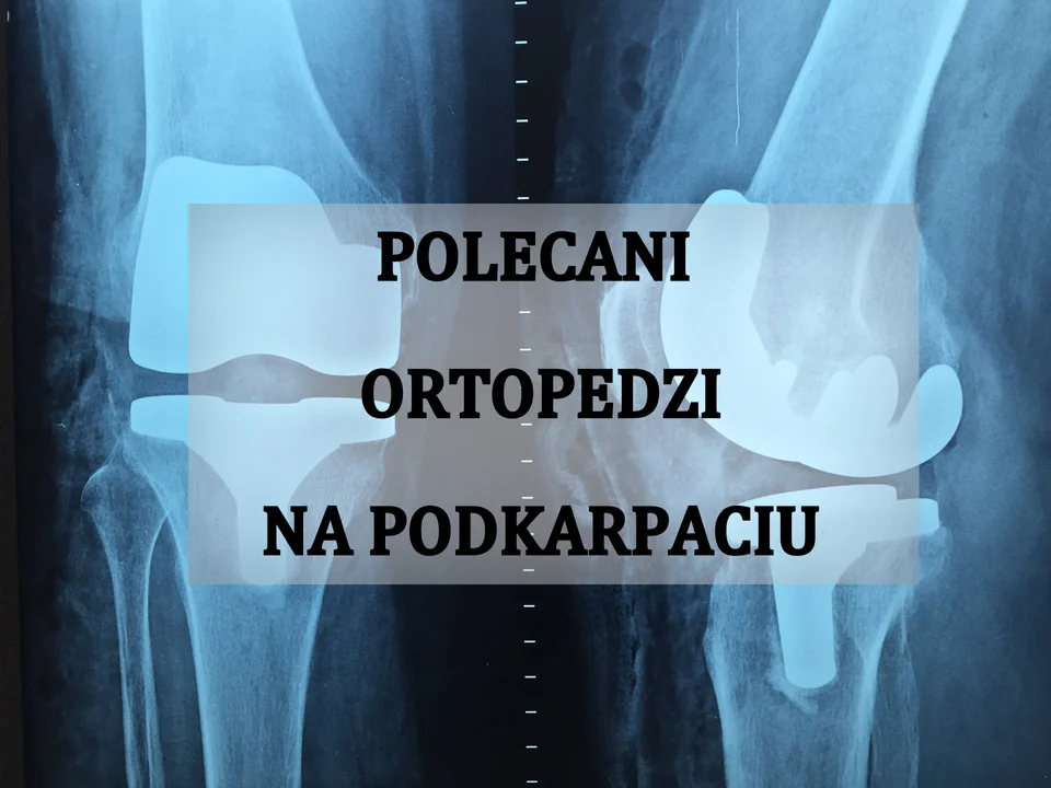 Poznaj najlepiej ocenianych ortopedów na Podkarpaciu. Sprawdź, którego masz w pobliżu. Ranking top 11 - Zdjęcie główne