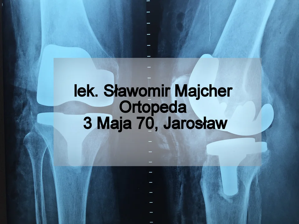 TOP 11 ortopedów na Podkarpaciu