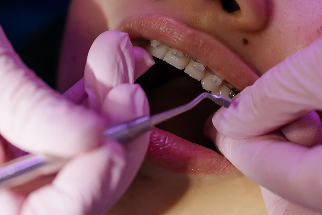 11 najlepszych ortodontów na Podkarpaciu. Sprawdź ranking