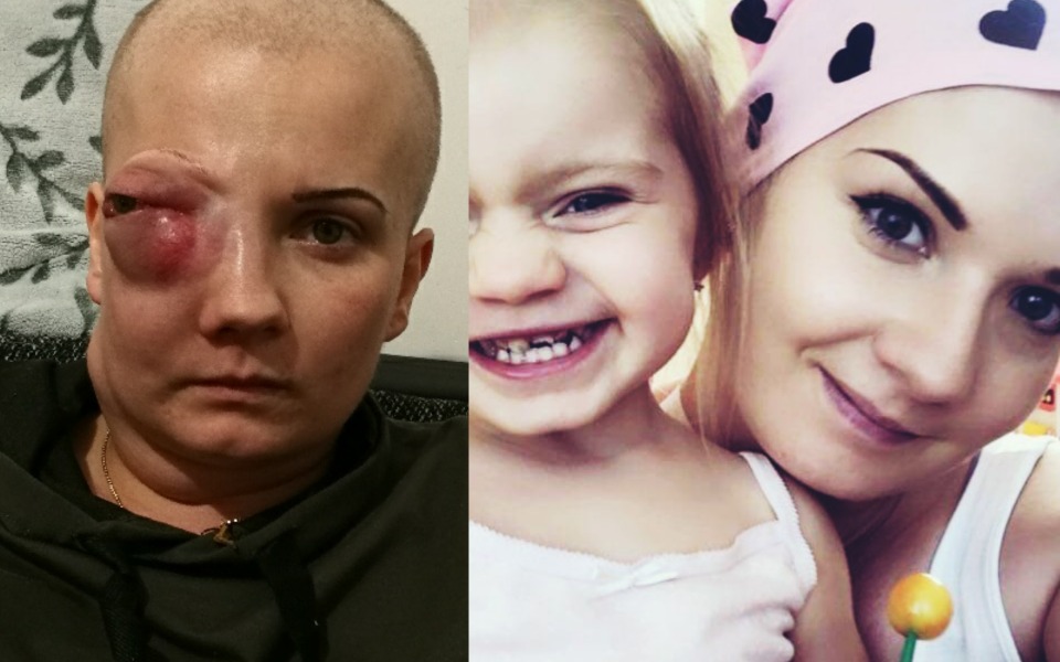 Podkarpacie: Młoda matka walczy z rakiem. Potrzeba 100 tys. zł - Zdjęcie główne