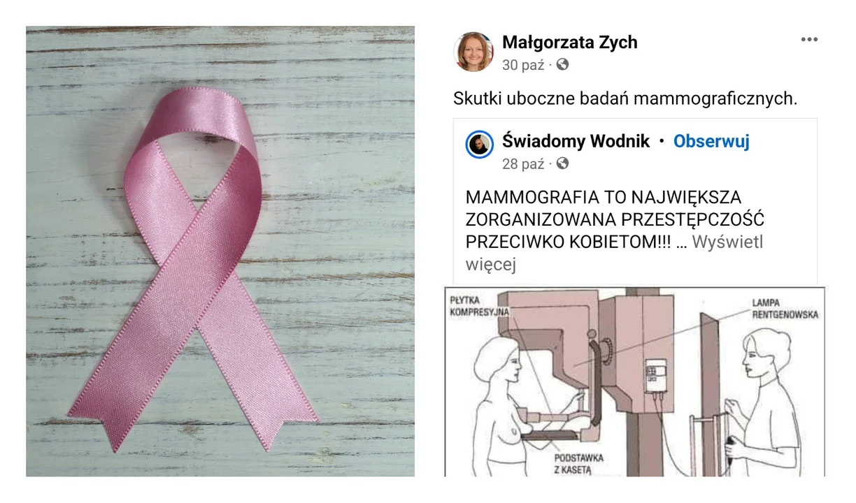 Fejk o szkodliwości mammografii krąży w sieci. Podała go dalej nawet była działaczka Konfederacji z Podkarpacia. Wyjaśniamy - Zdjęcie główne