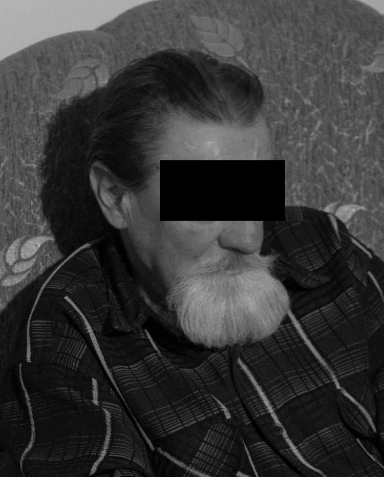 Poszedł na grzyby - znalazł ludzką głowę - Zdjęcie główne