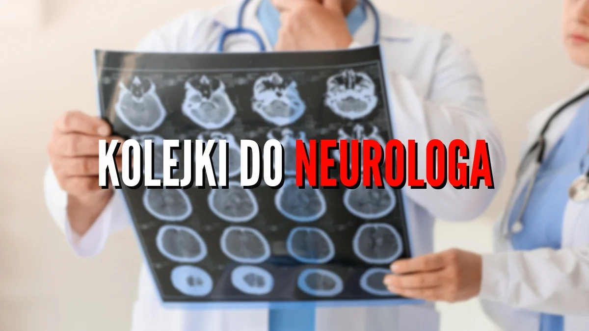 Gdzie do neurologa w Kolbuszowej? Tutaj są najdłuższe kolejki na NFZ. Pierwsza wizyta u lekarza dopiero w 2025 roku - Zdjęcie główne