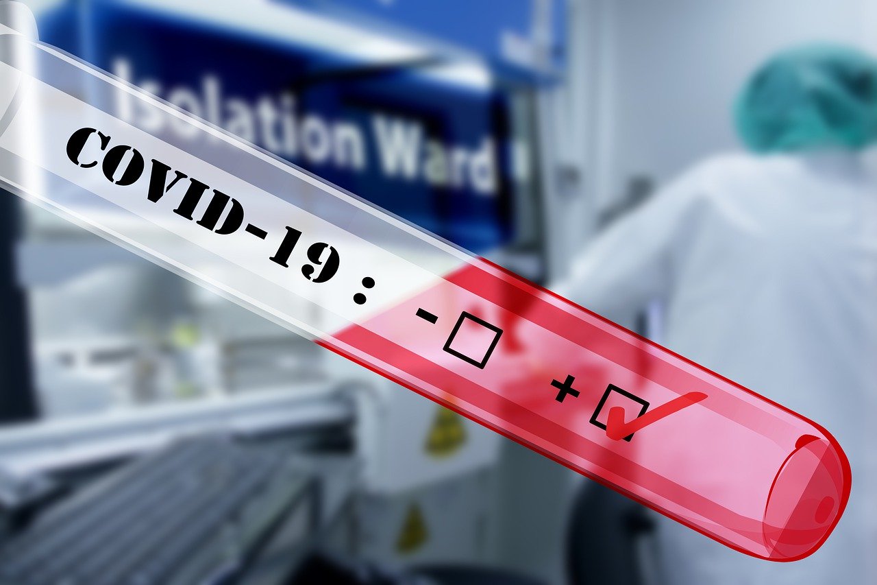 Przyspieszona diagnostyka koronawirusa. Wkrótce dostawa tzw. szybkich testów - Zdjęcie główne