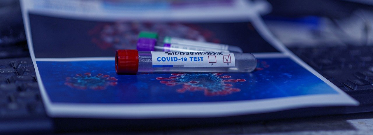Zasady zlecania testów na koronawirusa - Zdjęcie główne