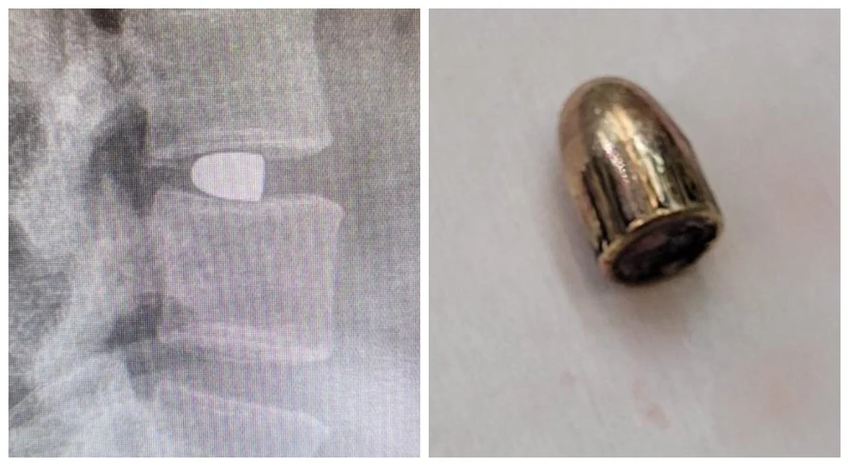 Przeżyła prawdziwą traumę. Została uruchomiona zbiórka dla Zuzanny, ofiary postrzelenia - Zdjęcie główne